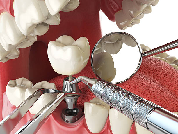 Best Cracked Tooth Emergency Dentist  in Fox Point, WI