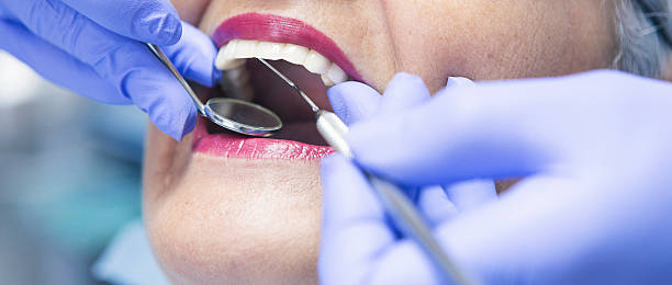 Best Emergency Dental Filling Replacement  in Fox Point, WI
